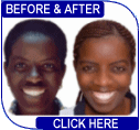 Skin Lightening tablets before and after